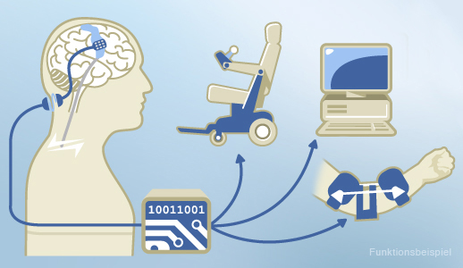 CorTec: University Spin-Off on its Way into the Future of Neurotechnology