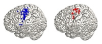 Mapping the Brain: Freiburg Researchers Use Signals from Natural Movements to Identify Brain Regions 