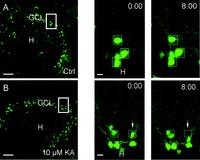 Migration of Dentate Granule Cells in Epilepsy