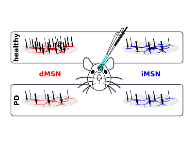 Balance of inputs to the striatum shifted towards the direct-pathway neurons in vivo, but not in Parkinson’s disease