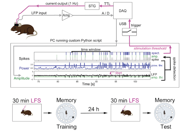 Innovative approach for treatment-resistant epilepsy